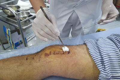 Phần thi thực hành của điều dưỡng Hà Công Tiến khoa Ngoại tổng hợp